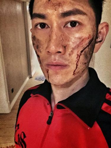 何明翰《爱人》热拍 晒挂彩自拍笑称被酒店嫌弃