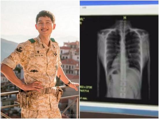 宋仲基X光藏玄机?《太阳》剧情走向竟是这样