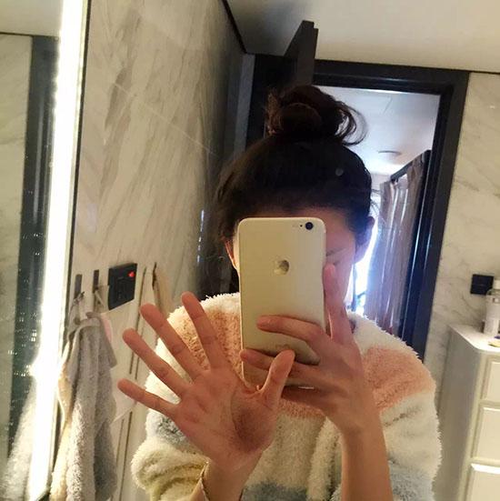 张予曦《奇星记》杀青 打戏受伤手掌显淤青