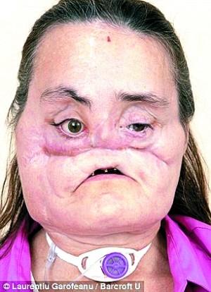 像《重生》的马可那样整出张新脸靠谱吗？