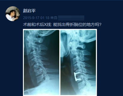 《欢乐颂》道具太较真！赵医生曲筱绡还有微博