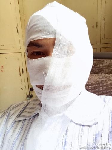 何明翰拍《我的仨妈俩爸》负伤？ 伤情引关注