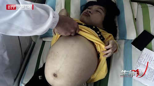 再掀生命的礼赞 “玻璃人”妈妈勇闯生死劫