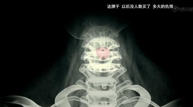 剧中女童吞果冻致死 旺旺公司起诉索赔被驳回