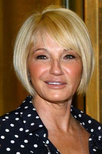 艾伦·巴金照片